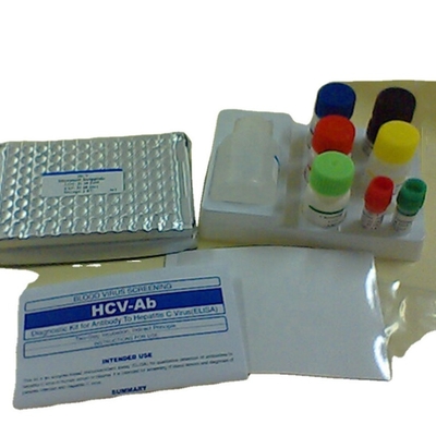 Interleukin 1 Beta elisa detection kit Human Il1b Elisa Kit Penggunaan Penelitian