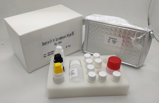 Kit CEA Elisa Sensitif Tinggi Deteksi Antigen Karsinoembrio Manusia