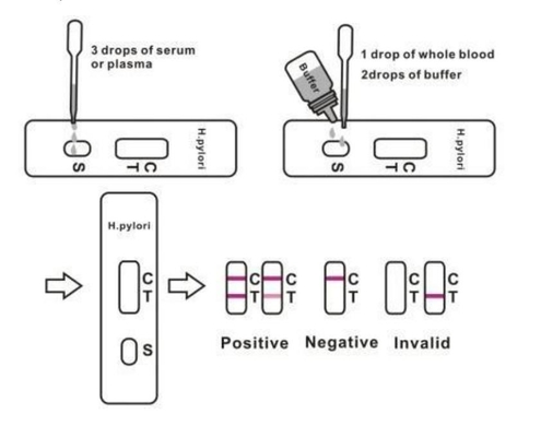 Kaset Antibodi Rapid Detection H Pylori Stool Test Kit